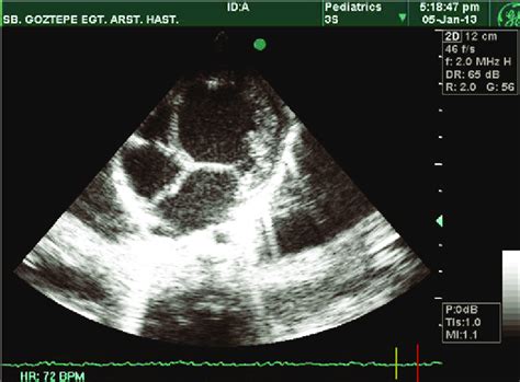 2d echo result|Iba pa.